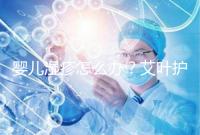 嬰兒濕疹怎么辦？艾葉護理不一定管用，4個小妙招輕松治療