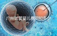 廣州試管嬰兒費(fèi)用知多少?2025年廣州試管全過程費(fèi)用與流程清單
