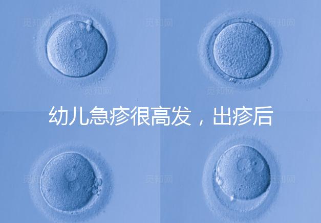 幼兒急疹很高發(fā)，出疹后的護(hù)理方法及注意事項(xiàng)提前知曉！