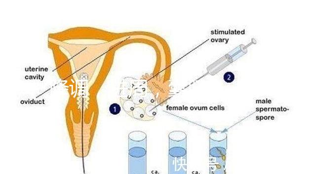降調(diào)，進(jìn)周，囊胚……這些試管嬰兒助孕術(shù)語(yǔ)你都懂嗎？