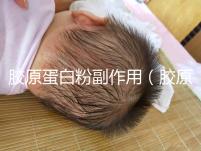 膠原蛋白粉副作用(膠原蛋白粉副作用和危害)