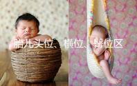 胎兒頭位、橫位、臀位區別大，5個方面教你分辨