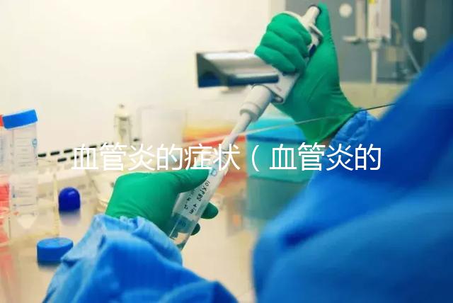 血管炎的癥狀(血管炎的癥狀有哪些)