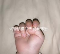 試管移植29天能看到胎心嗎?B超還能看孕囊大小和胎心