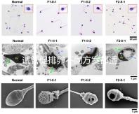 試管促排卵不同方案都適合哪些人？如何監測排卵？