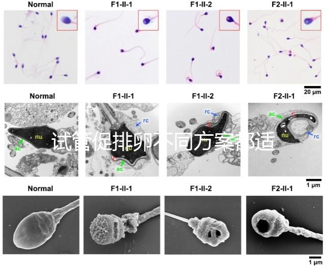 試管促排卵不同方案都適合哪些人？如何監(jiān)測(cè)排卵？