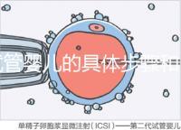 試管嬰兒的具體步驟和(做試管的流程順序)