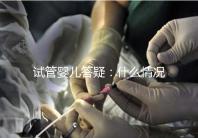 試管嬰兒答疑：什么情況下需要進(jìn)行PGS和PGD？