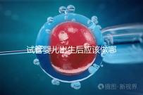 試管嬰兒出生后應該做哪些檢查答案？DR應該看情況嗎？