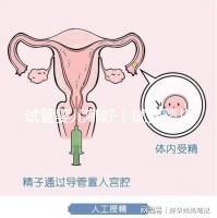 試管嬰兒哪好（試管嬰兒權(quán)威醫(yī)院哪家最好）