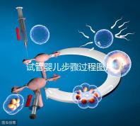 試管嬰兒步驟過(guò)程圖片