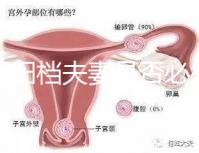 試管歸檔夫妻是否必須登記，一個(gè)號碼可以看到這篇文章就足夠了