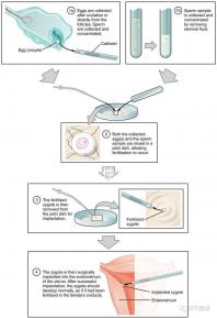 貴陽(yáng)單身女性禁止凍卵?持“三證”已婚女性就能凍卵