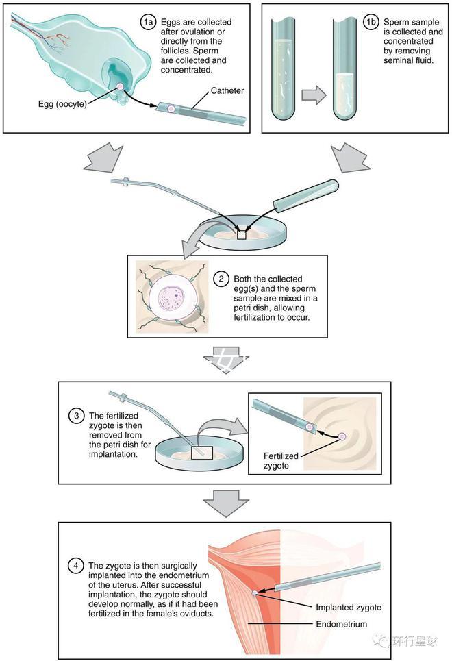 貴陽(yáng)未婚子女戶口如何向婦女介紹，附2024年結(jié)算流程