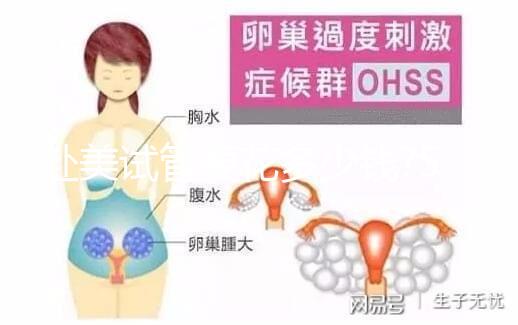 赴美試管要花多少錢?5大收費(fèi)看懂美國(guó)試管嬰兒貴在哪里