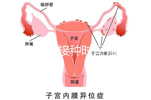 麻疹疫苗接種時(shí)間指南，初種年齡最好不要晚于這個(gè)月齡