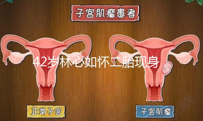 42歲林心如懷二胎現身新活動，霍建華全程陪同產檢回應