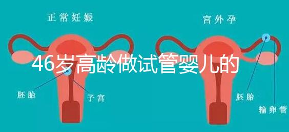 46歲高齡做試管嬰兒的成功幾率有多大?聽(tīng)聽(tīng)大家怎么說(shuō)