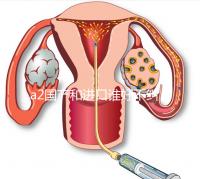 a2國產和進口誰好不糾結，看配方、口感、價格對比再選