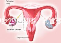 39歲四促四移,試管移植失敗5次后應該怎么辦?