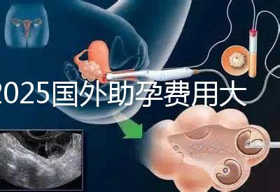 2025國外助孕費用大公開：單身人士費用對比與機構(gòu)推薦