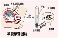 tct檢查后癥狀一覽，專家提醒做好處理措施是關鍵