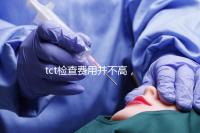 tct檢查費用并不高,不同醫院收費標準不一樣